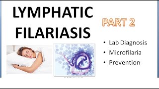 PSM 290 Lymphatic Filariasis Part 2 Lab Diagnosis Microfilaria Prevention DEC Provocation Test [upl. by Refotsirk]