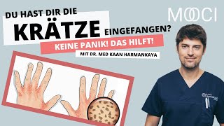 Krätze erkennen amp behandeln Das hilft gegen Milben [upl. by Handbook803]